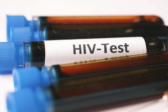 HIV AIDS Quick Link - Testing.jpg